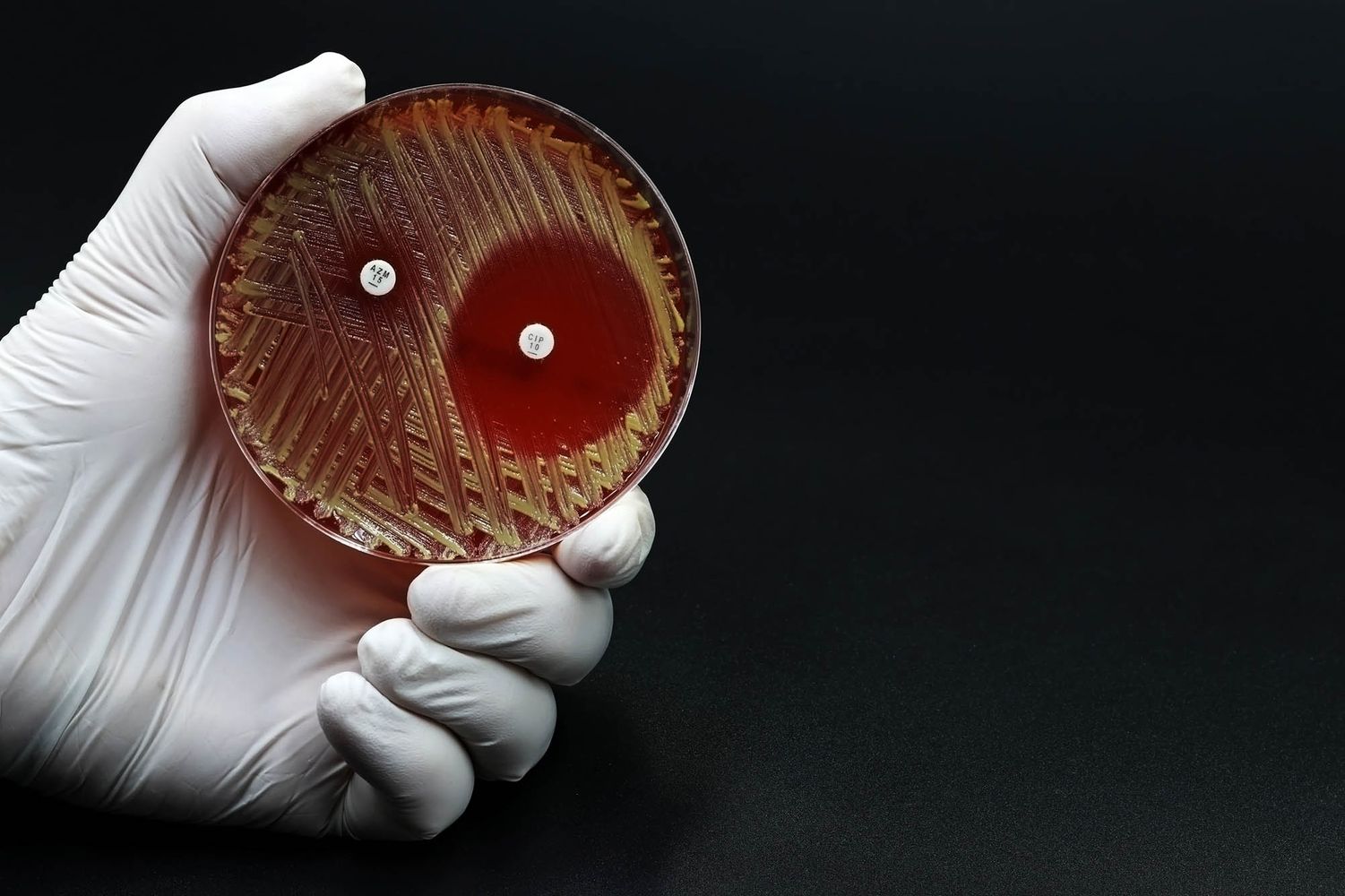 Photo: Stock of a white latex gloved hand holding a Petri dish with a microbiological culture Petri dish with bacteria where an antibiotic resistance test has been carried out.