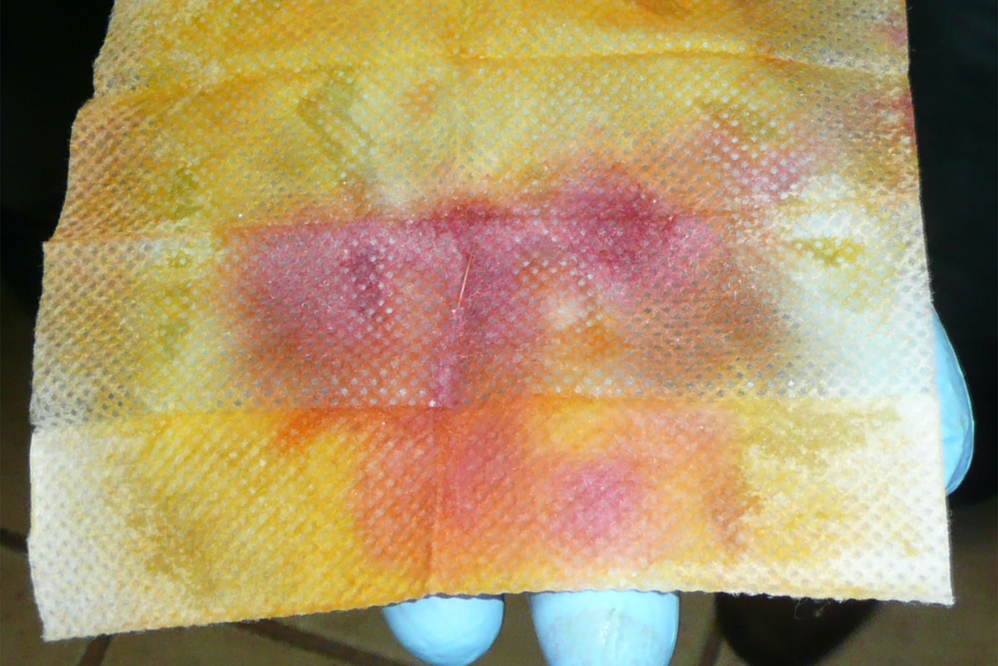 Photo: A wipe that has splotches of red amidst yellow coloring being held by a blue-gloved hand
