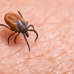 Photo: A stock photo of a deer tick zoomed in on skin.
