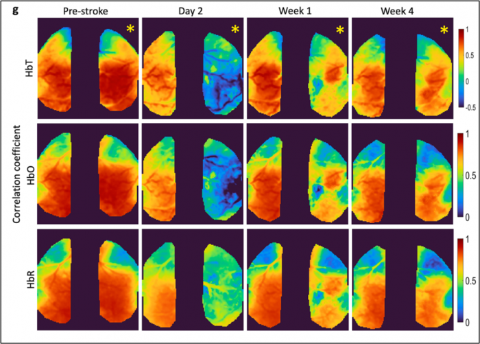 montage of brain scan images