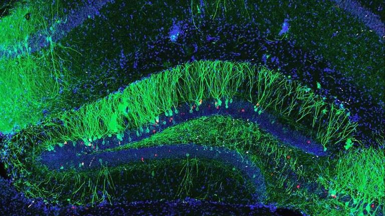 microscopic image of stained brain cells