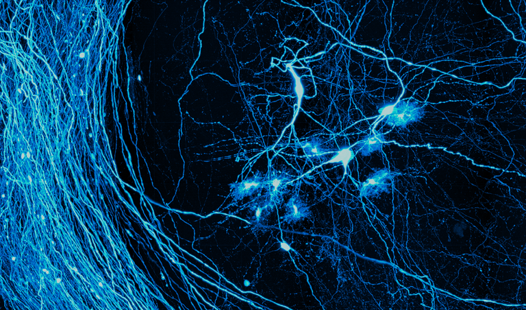 A microscope view of an illuminated neuron