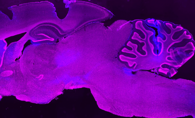 Kilachand Photo Contest first Prize Photograph