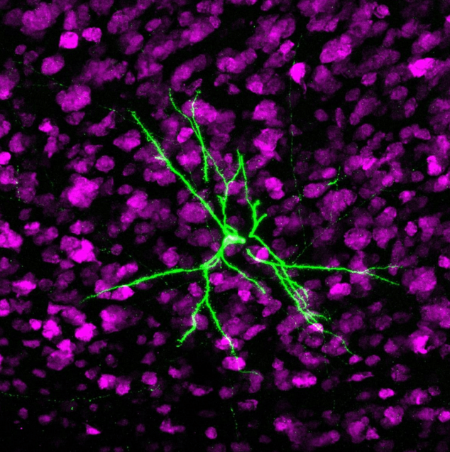 Kilachand Photo Contest Second Prize Photograph