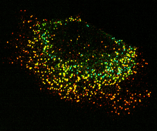 Kilachand Photo Contest Honorable Mention Photograph 4