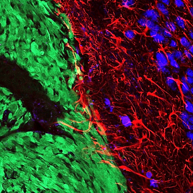 Kilachand Photo Contest Honorable Mention Photograph 5