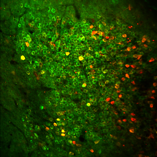 a microscopic image of cells in a mouse brain