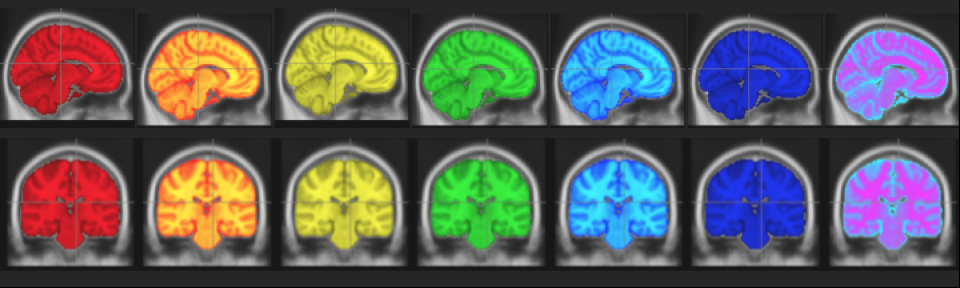 rainbow brains image