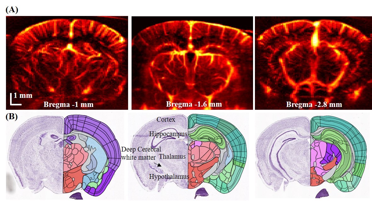 Functional Ultrasound Imaging Neurophotonics Center