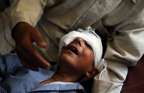 1472448413_kashmir-pellet-child