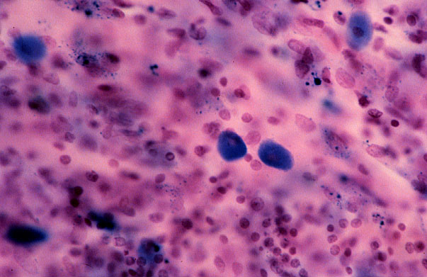  mast cells 