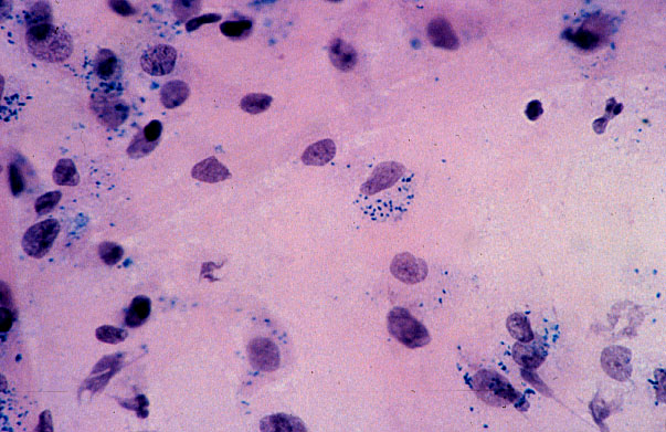  macrophages 