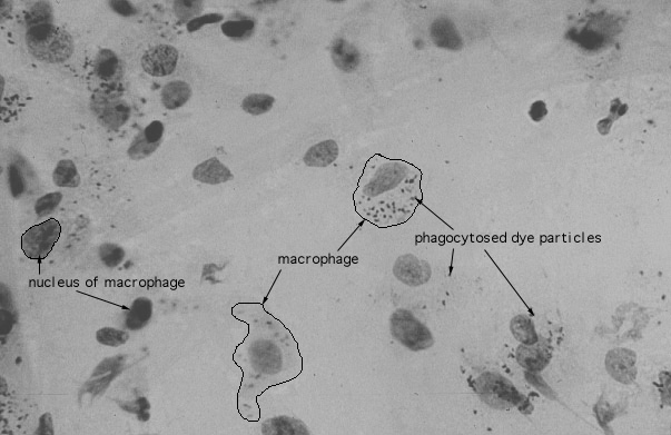  macrophages 