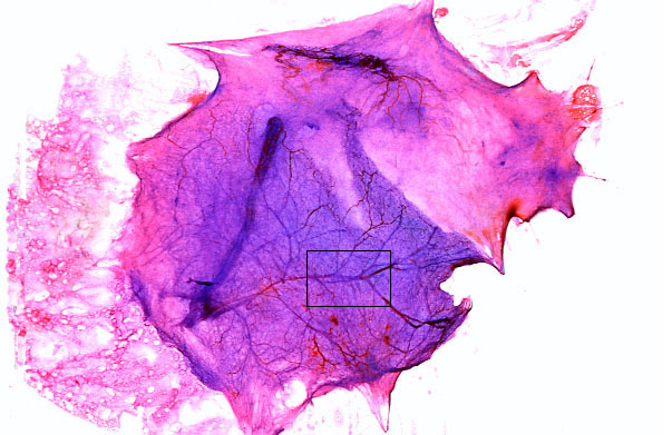  spread areolar connective tissue 