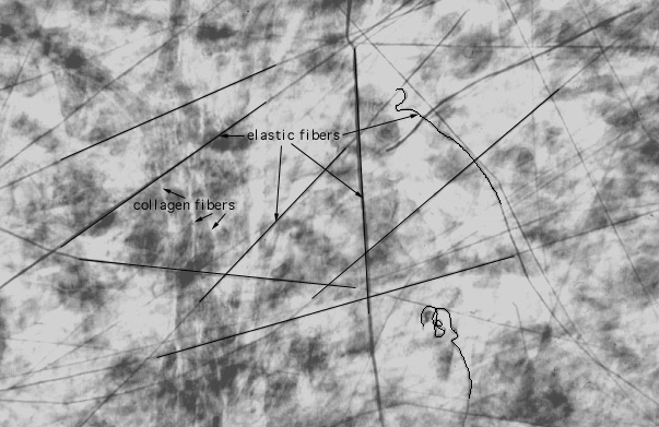  elastic fibers 
