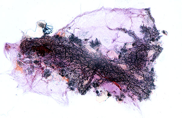  arterioles and capillaries, mesentery 