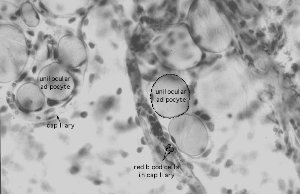  unilocular (white) adipocytes 