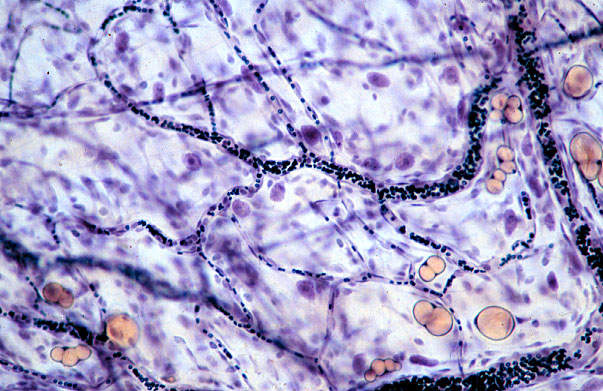  arterioles and capillaries, mesentery 