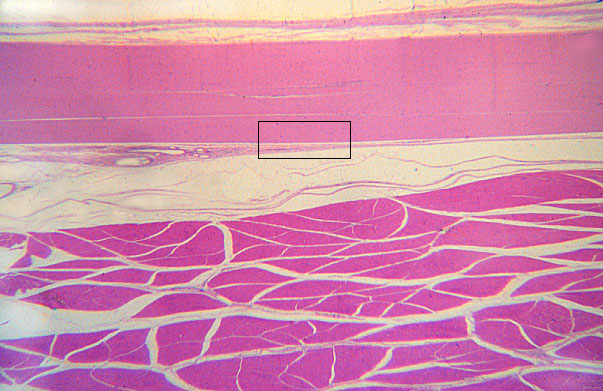  dense regular connective tissue, longitudinal 