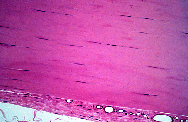  dense regular connective tissue, longitudinal 