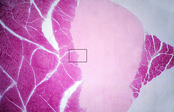  dense regular connective tissue, transverse 