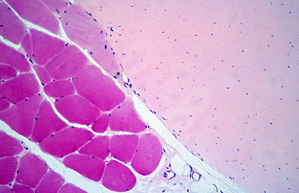  dense regular connective tissue, transverse 
