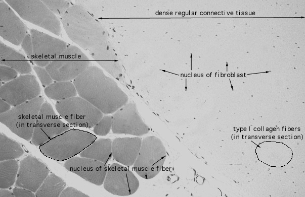  dense regular connective tissue, transverse 