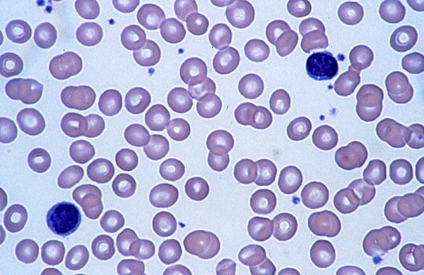  lymphocytes 