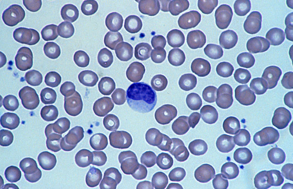  monocyte 