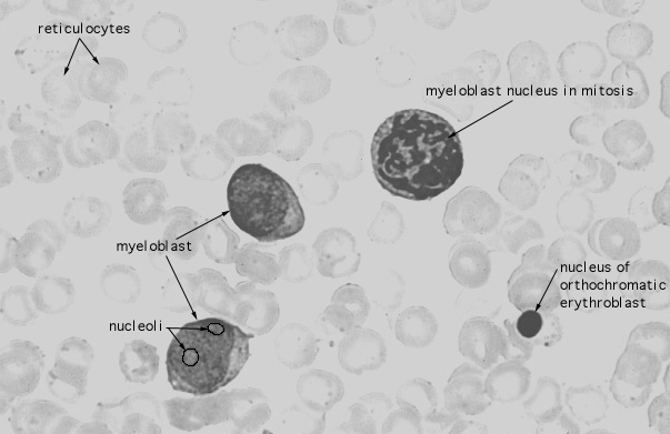  bone marrow smear 