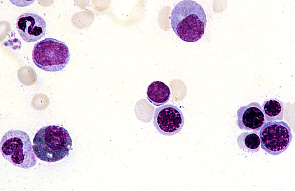  bone marrow smear, erythroblast series 