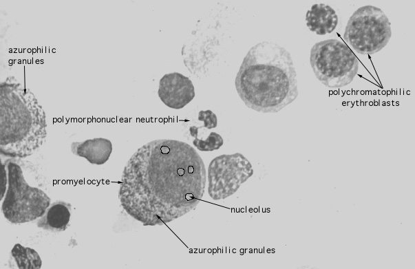  bone marrow smear, promyelocyte and erythroblasts 
