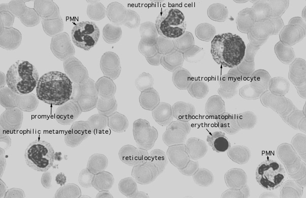  bone marrow smear, neutrophil series 
