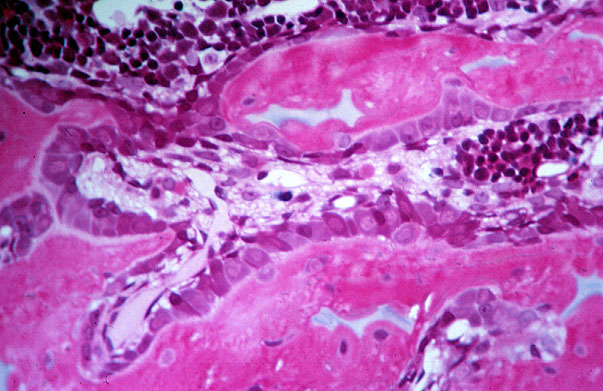  cells of bone 