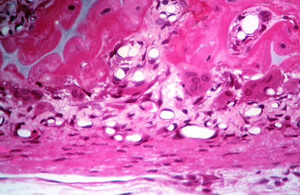  cells of bone 
