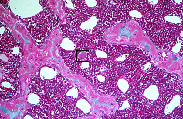  red marrow, section 