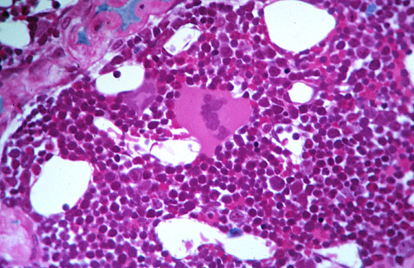  red marrow, section 