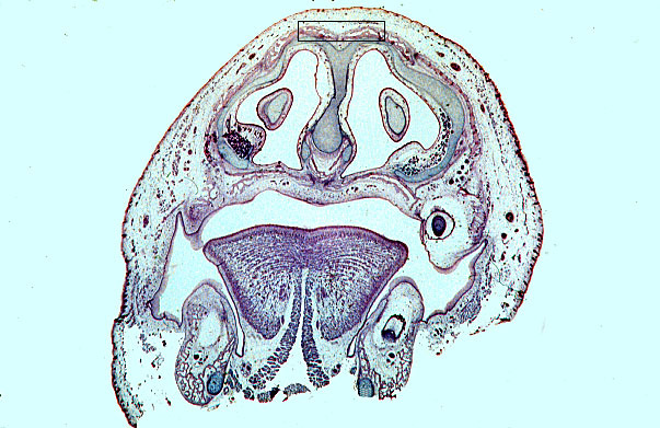  fetal head I 