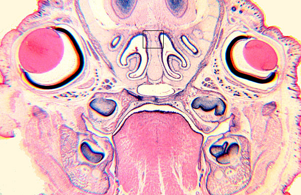  fetal head II 