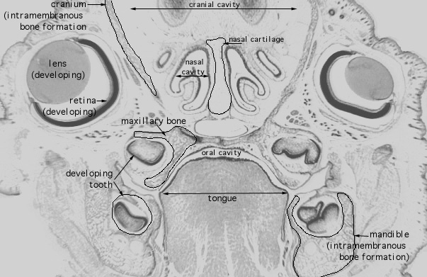  bone modeling 