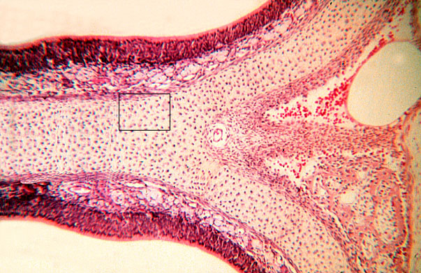  hyaline cartilage 