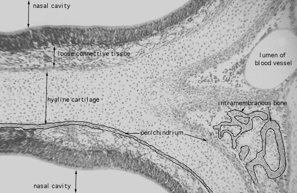  hyaline cartilage 
