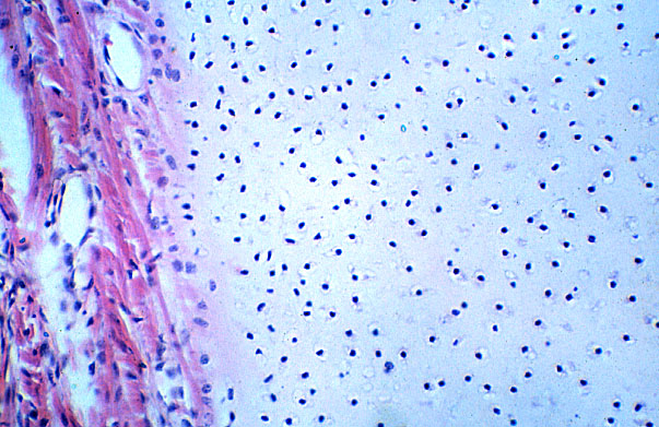  hyaline cartilage 