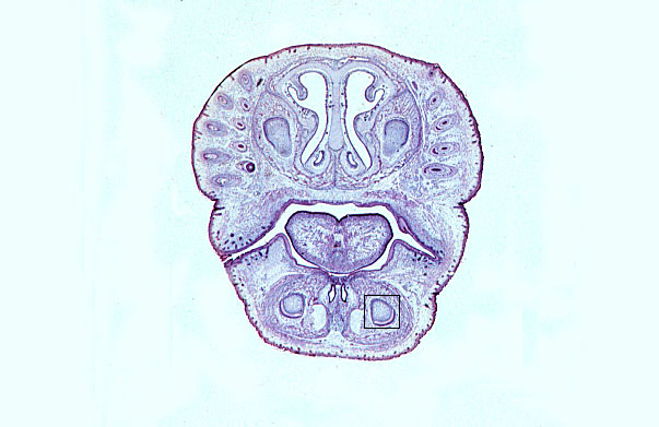  fetal rat (mid), developing tooth 