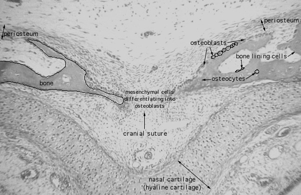  intramembranous bone formation 
