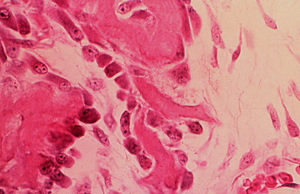  hyaline cartilage; intramembranous bone formation 