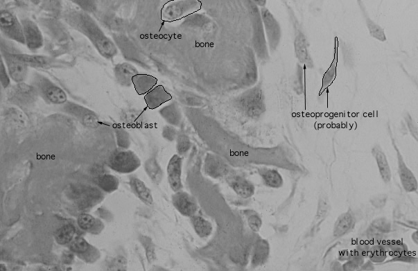  hyaline cartilage; intramembranous bone formation 