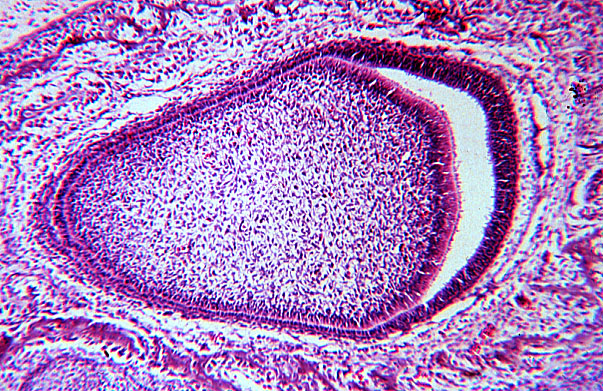  fetal rat, developing tooth, enamel 