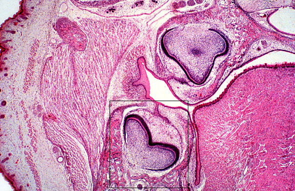  fetal rat, developing tooth 