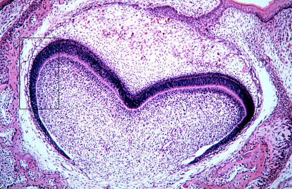  fetal rat, developing tooth, dental papillae 